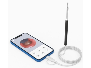 HD Smart Visual Ear Nose Mouth Smartphone Otoskop Ohrreinigungskamera